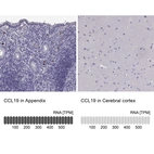 Anti-CCL19 Antibody