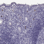 Immunohistochemical staining of human appendix shows strong cytoplasmic positivity in lymphoid cells.