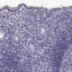 Immunohistochemical staining of human appendix shows strong cytoplasmic positivity in lymphoid cells.