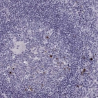 Immunohistochemical staining of human tonsil shows moderate to strong cytoplasmic positivity in lymphoid cells.