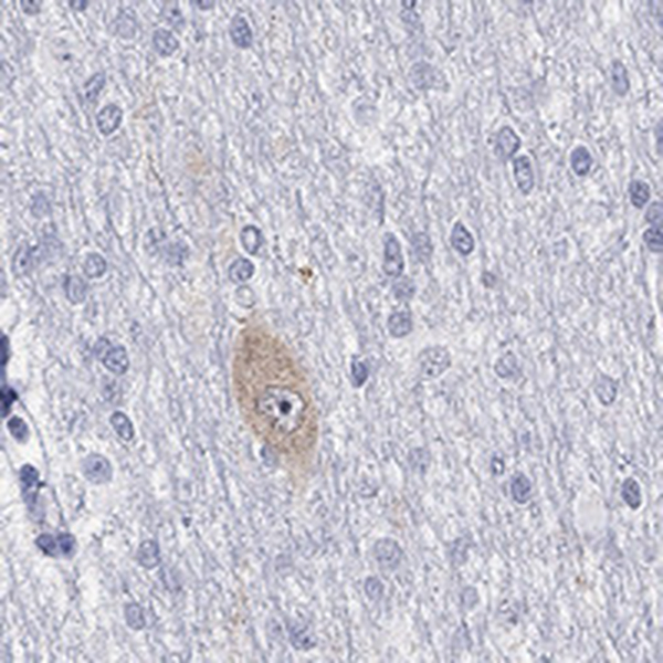 Anti-GRIN1 Antibody