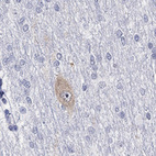Anti-GRIN1 Antibody