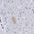 Anti-GRIN1 Antibody