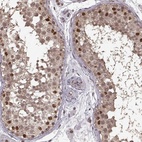Anti-NR2C1 Antibody