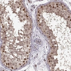 Immunohistochemical staining of human testis shows high expression.