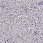 Anti-NR2C1 Antibody
