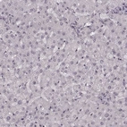 Immunohistochemical staining of human liver shows low expression as expected.