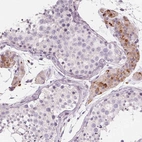 Immunohistochemical staining of human testis shows moderate granular pattern cytoplasmic positivity in Leydig cells.