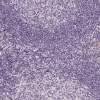 Immunohistochemical staining of human tonsil shows no cytoplasmic positivity in non-germinal center cells and germinal center cells as expected.