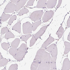 Immunohistochemical staining of human skeletal muscle shows negative cytoplasmic positivity in myocytes as expected.