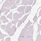 Immunohistochemical staining of human skeletal muscle shows negative cytoplasmic positivity in myocytes as expected.