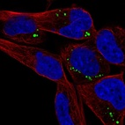 Immunofluorescent staining of human cell line RH-30 shows localization to vesicles.