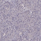 Immunohistochemical staining of human pancreas shows low expression as expected.