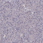 Immunohistochemical staining of human pancreas shows low expression as expected.