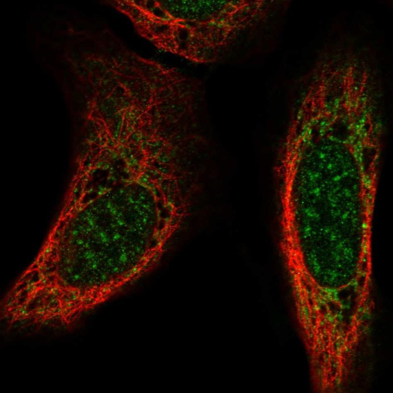 Anti-CSPG5 Antibody