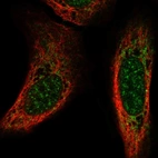 Anti-CSPG5 Antibody