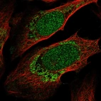 Anti-ZNF223 Antibody