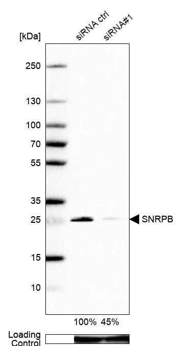 Anti-SNRPB Antibody