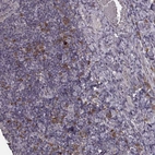 Anti-P2RX5 Antibody