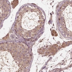 Anti-GJA9 Antibody