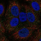 Immunofluorescent staining of human cell line MCF7 shows localization to cytoplasmic bodies.