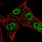 Immunofluorescent staining of human cell line SK-MEL-30 shows localization to nuclear speckles.
