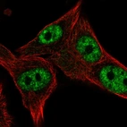 Immunofluorescent staining of human cell line SK-MEL-30 shows localization to nuclear speckles.