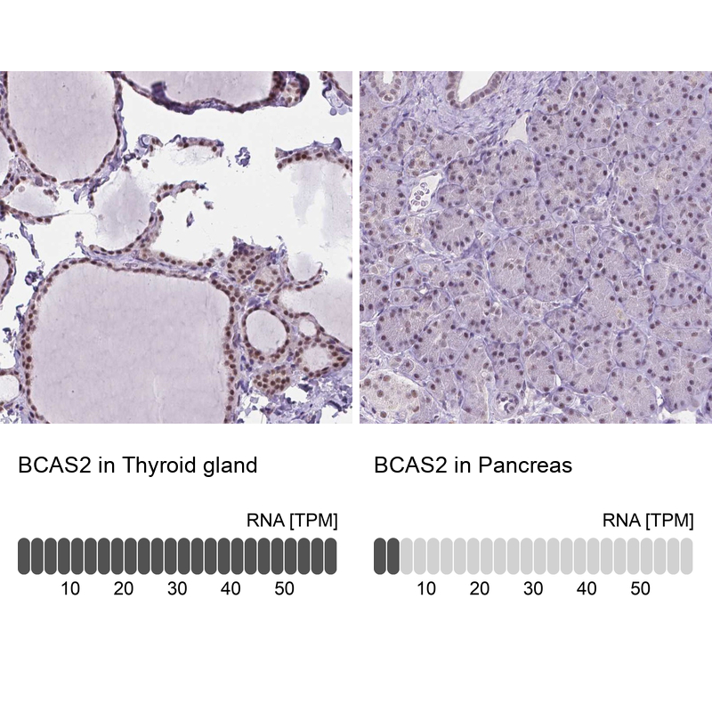 Anti-BCAS2 Antibody