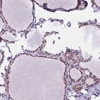 Immunohistochemical staining of human thyroid gland shows high expression.