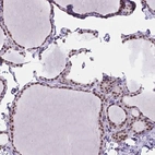Immunohistochemical staining of human thyroid gland shows high expression.