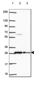 Lane 1: Marker [kDa] 250, 130, 95, 72, 55, 36, 28, 17, 10_br/_Lane 2: Human cell line RT-4_br/_Lane 3: Human cell line U-251 MG