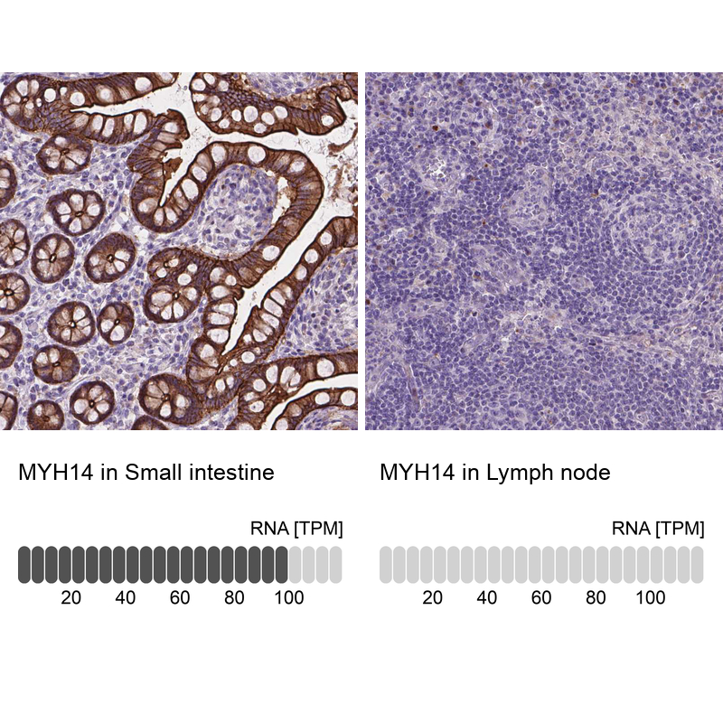 Anti-MYH14 Antibody