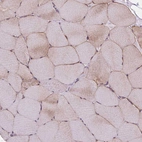 Immunohistochemical staining of human skeletal muscle shows moderate cytoplasmic positivity in myocytes.