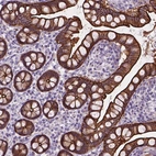 Immunohistochemical staining of human small intestine shows strong cytoplasmic positivity in glandular cells.