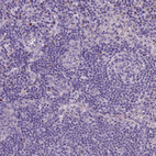 Immunohistochemical staining of human lymph node shows no cytoplasmic positivity in germinal center cells as expected.