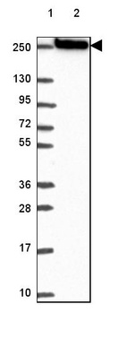 Lane 1: Marker [kDa] 250, 130, 95, 72, 55, 36, 28, 17, 10_br/_Lane 2: Human cell line RT-4