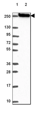 Lane 1: Marker [kDa] 250, 130, 95, 72, 55, 36, 28, 17, 10_br/_Lane 2: Human cell line RT-4