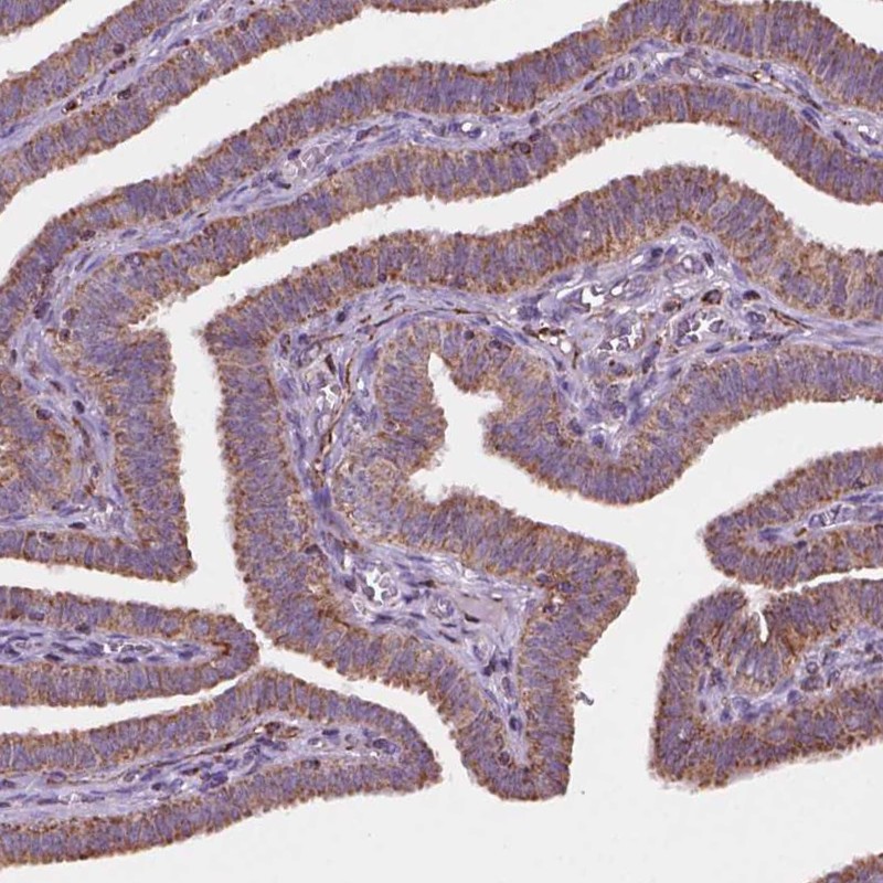 Anti-GEMIN4 Antibody