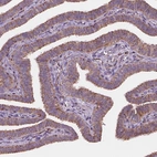 Anti-GEMIN4 Antibody