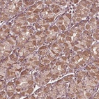 Anti-CDKL4 Antibody