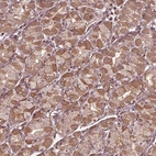 Anti-CDKL4 Antibody