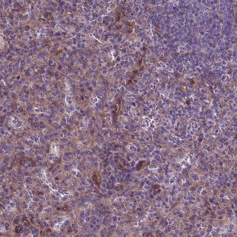 Anti-FLT4 Antibody