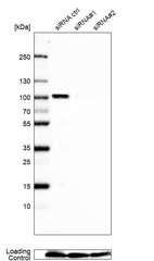 Anti-NCAPH2 Antibody