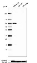 Anti-NCAPH2 Antibody