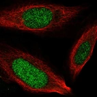 Immunofluorescent staining of human cell line U-2 OS shows localization to nucleus.