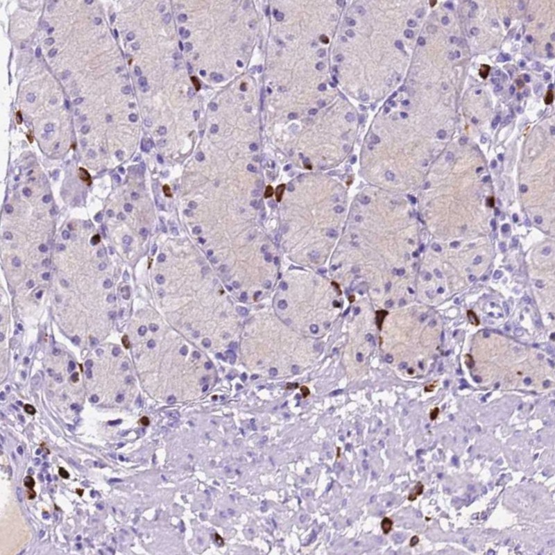 Anti-FOXB2 Antibody