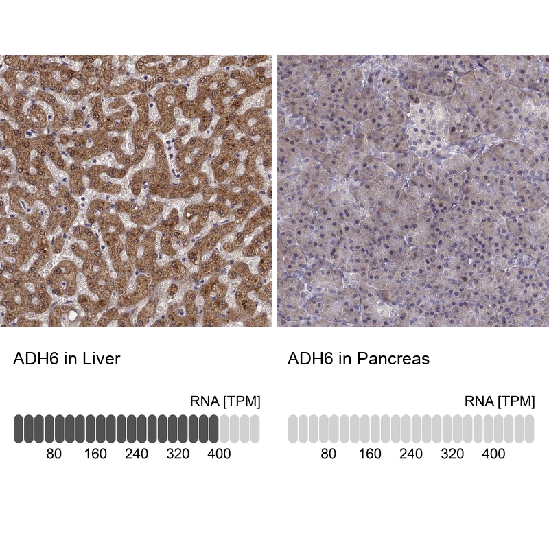 Anti-ADH6 Antibody