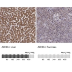 Anti-ADH6 Antibody