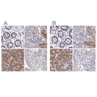 Immunohistochemical staining of human colon, kidney, liver and testis using Anti-ADH6 antibody HPA067946 (A) shows similar protein distribution across tissues to independent antibody HPA069081 (B).