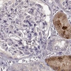 Immunohistochemical staining of human kidney using Anti-ADH6 antibody HPA067946.